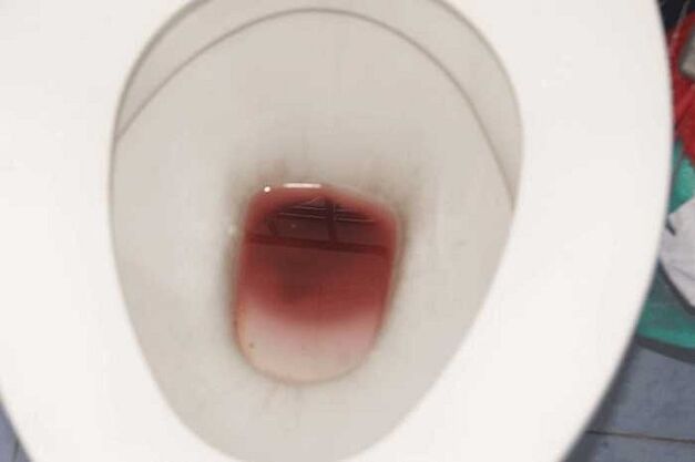 Avvistamenti negli uomini quando sono eccitati